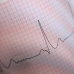 Lettura ed interpretazione dell’ ECG