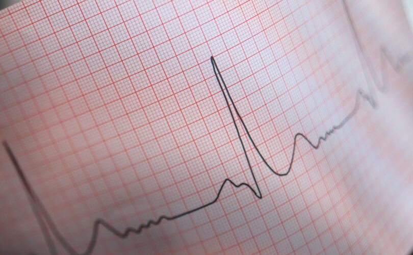 Lettura ed interpretazione dell' ECG